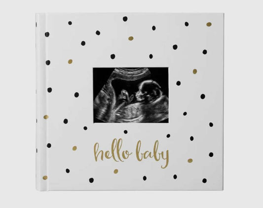 “Hello Baby” Photo Album